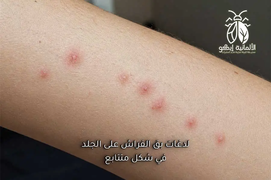 علامات وجود بق الفراش