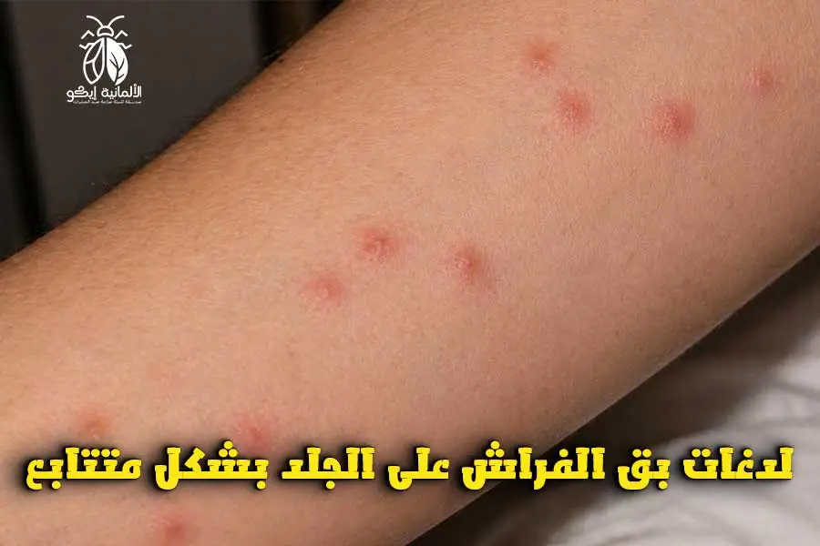 حشرة البق